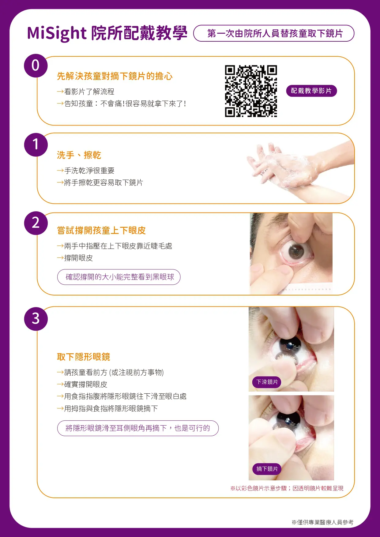 兒童近視控制隱形眼鏡介紹，兒童近視矯正- 羅眼科診所