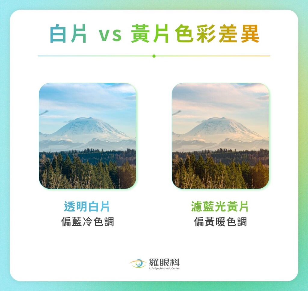 人工水晶體怎麼選?人工水晶體類型、挑選方式、手術常見問題一覽 4 白片 vs 黃片人工水晶體