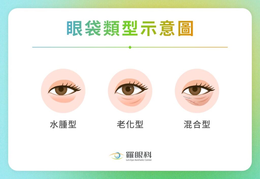 眼袋類型示意圖